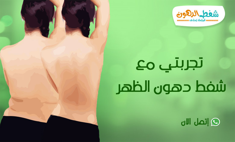 شفط دهون الظهر والجوانب: تفاصيل كاملة وتجارب ناجحة