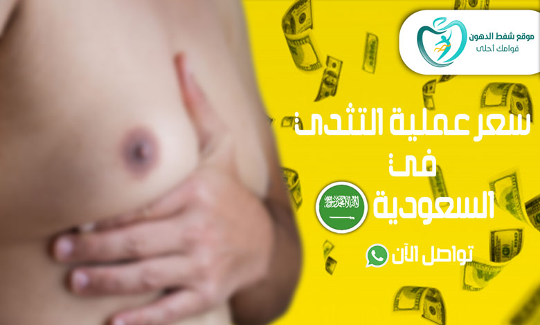 سعر عملية التثدي في السعودية