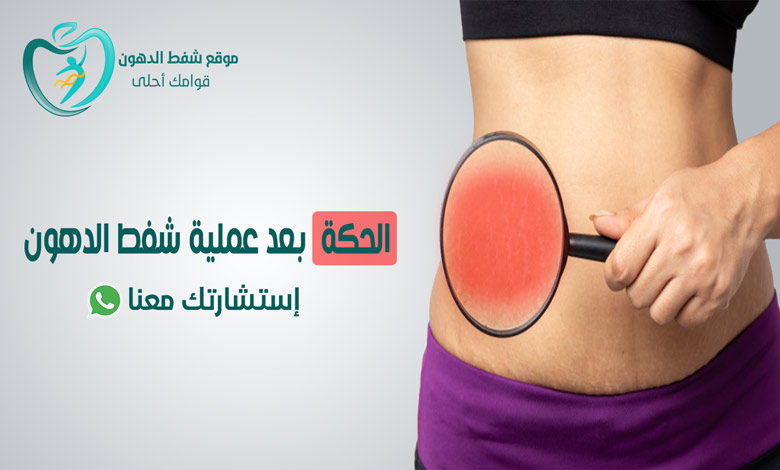 الحكة بعد عملية شفط الدهون