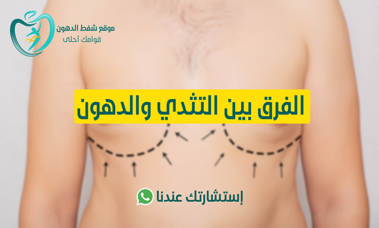 ما الفرق بين التثدي والدهون
