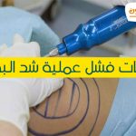 علامات فشل عملية شد البطن