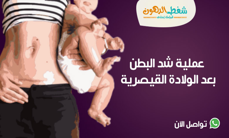 سعر عملية شد البطن بعد الولادة