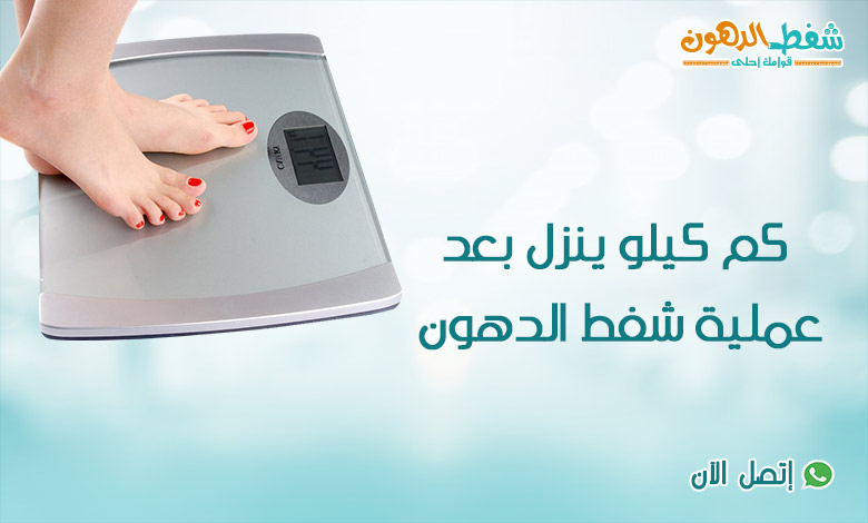 كم كيلو ينزل بعد عملية شفط الدهون؟