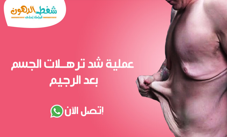 شد ترهلات الجسم بعد الرجيم للرجال