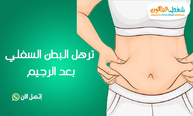 ترهل البطن السفلية بعد الرجيم