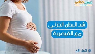 تجربتي مع شد البطن مع الولادة القيصرية