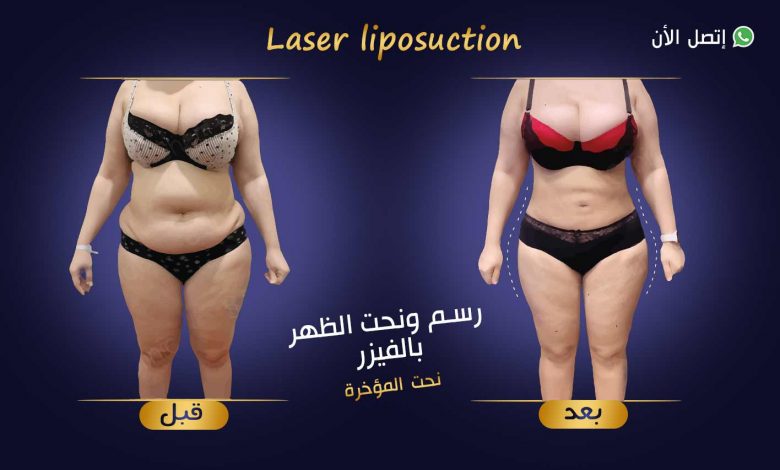 نصائح بعد حقن المؤخرة بالدهون الذاتية