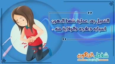التنميل بعد عملية شفط الدهون
