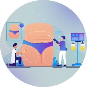 عمليات شفط لدهون